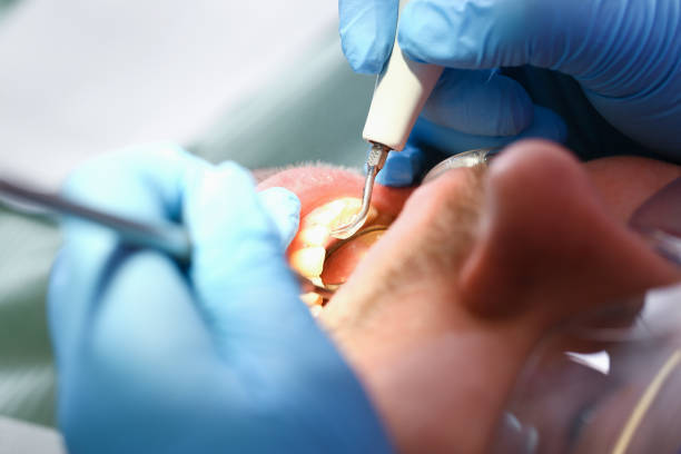 Best Emergency Denture Repair in Otisville, NY
