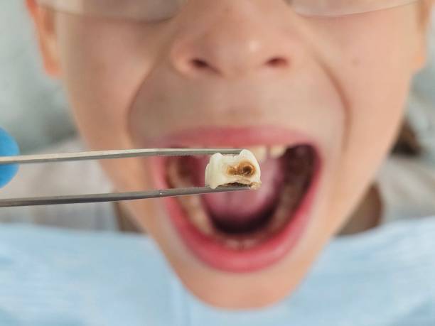 Best Emergency Denture Repair in Otisville, NY